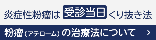 粉瘤（アテローム）の治療法 リンクバナー